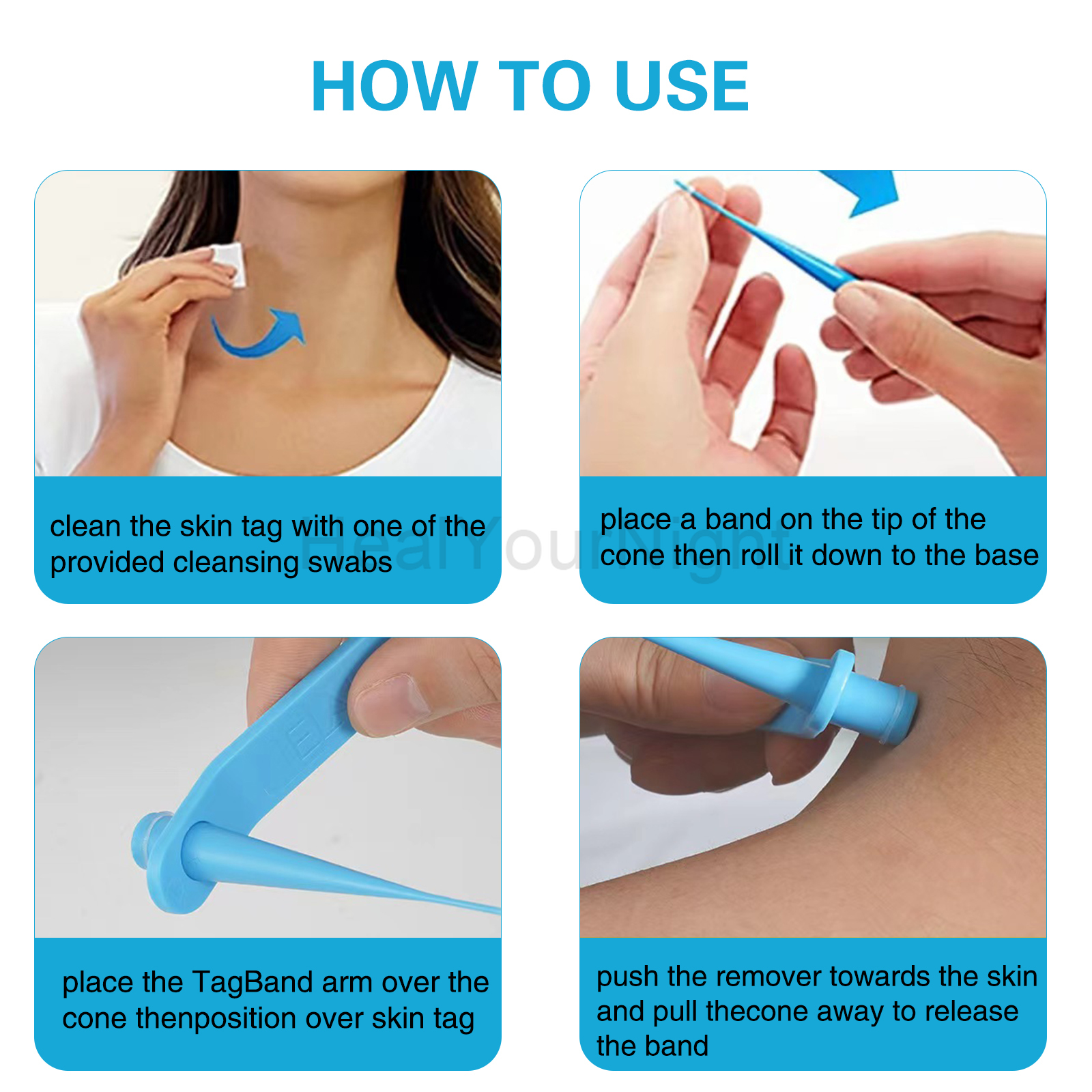 3-IN-1 Auto Skin Tag Removal K – обзор и цена Acne Light Therapy Pen