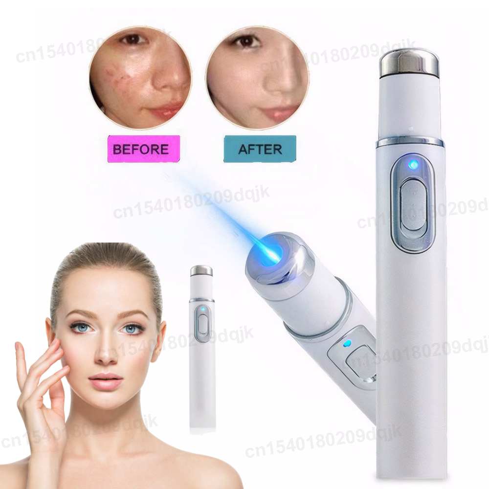Blue Light Therapy Acne Pen LE – обзор и цена Acne Light Therapy Pen