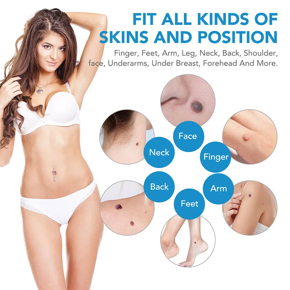 Auto Skin Tag Removal Tool Kit – обзор и цена Acne Light Therapy Pen